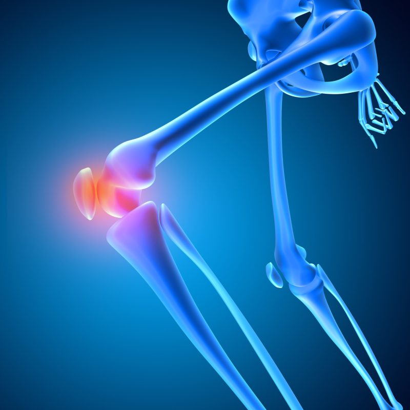 Best Knee Replacement Surgery In Hyderabad And Medak Medicare Hospitals